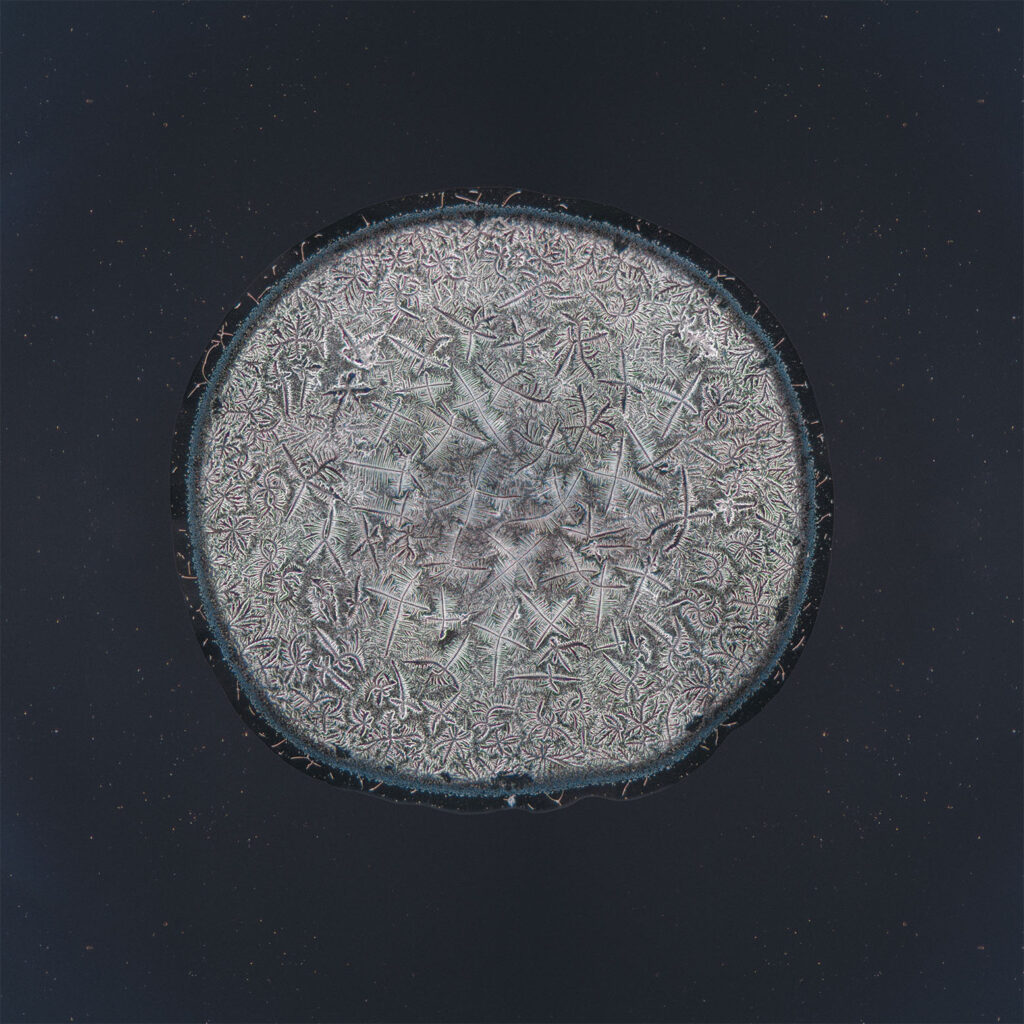 Anna — emotional tear photographed under the microscope
