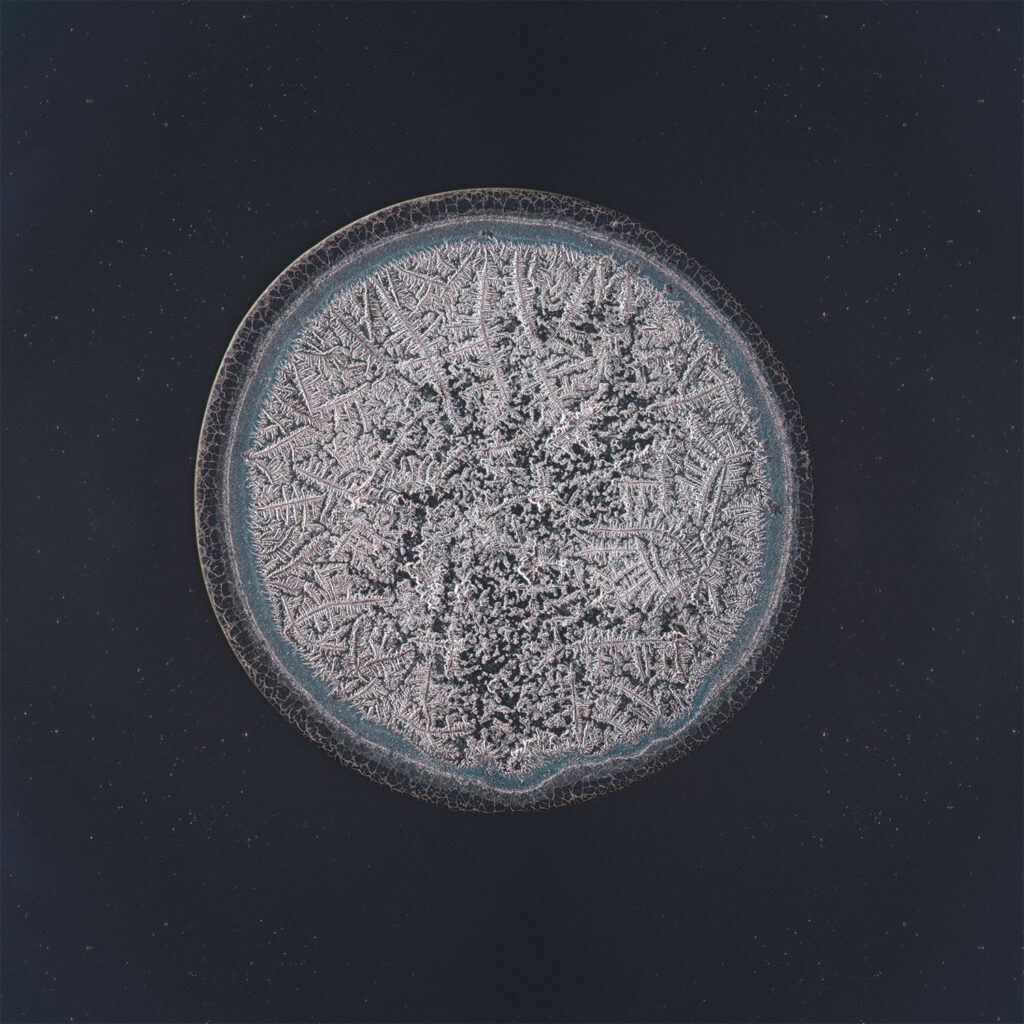 Choi — emotional tear photographed under the microscope