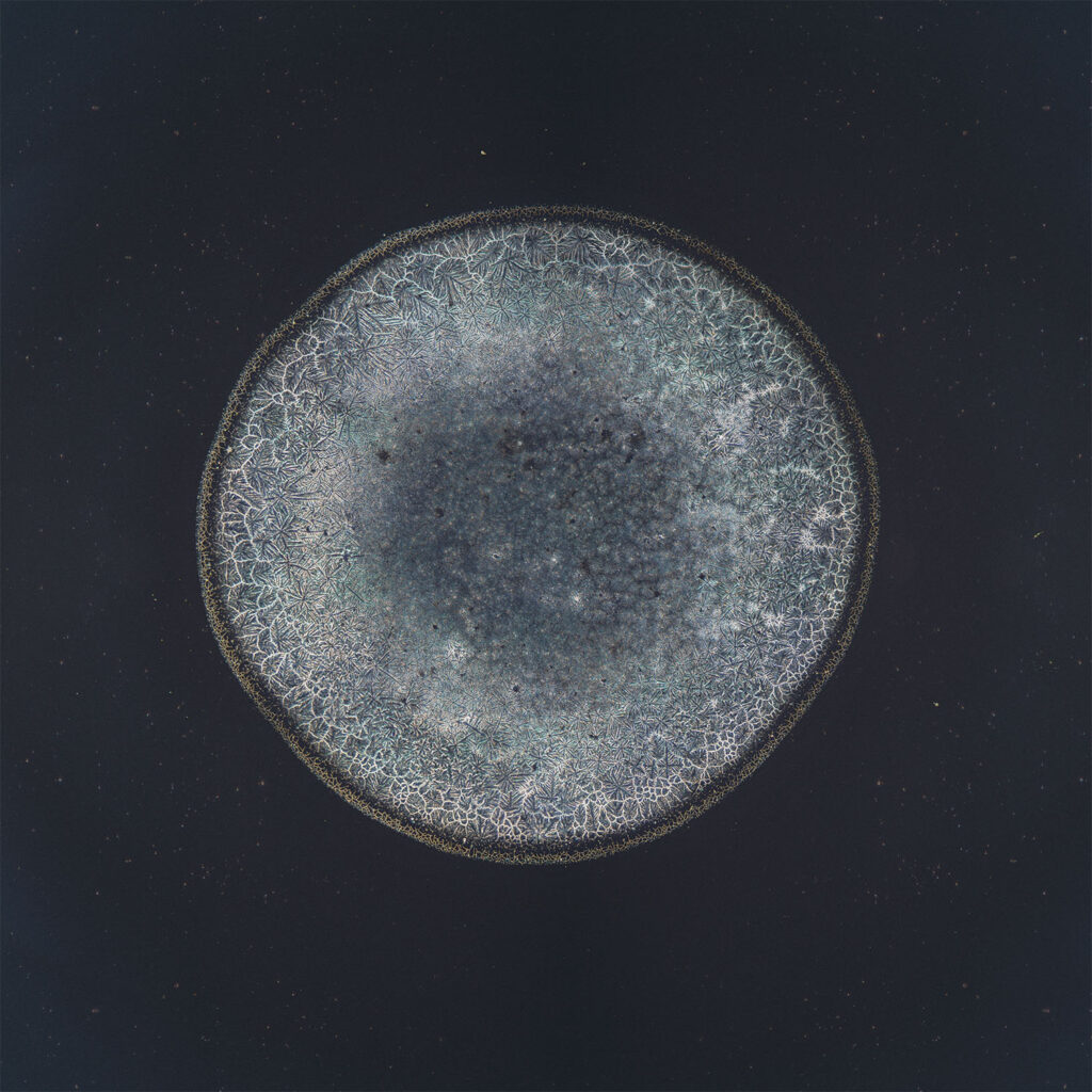 Claudia — emotional tear photographed under the microscope