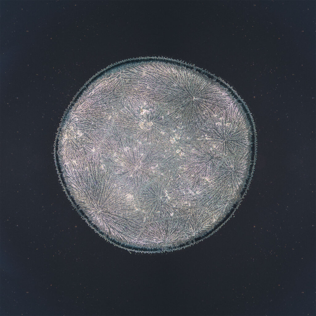 Lola — emotional tear photographed under the microscope