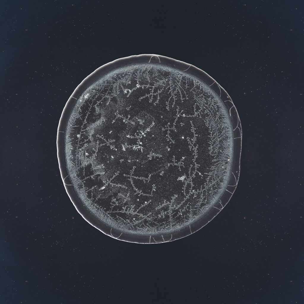 Lorraine — emotional tear photographed under the microscope