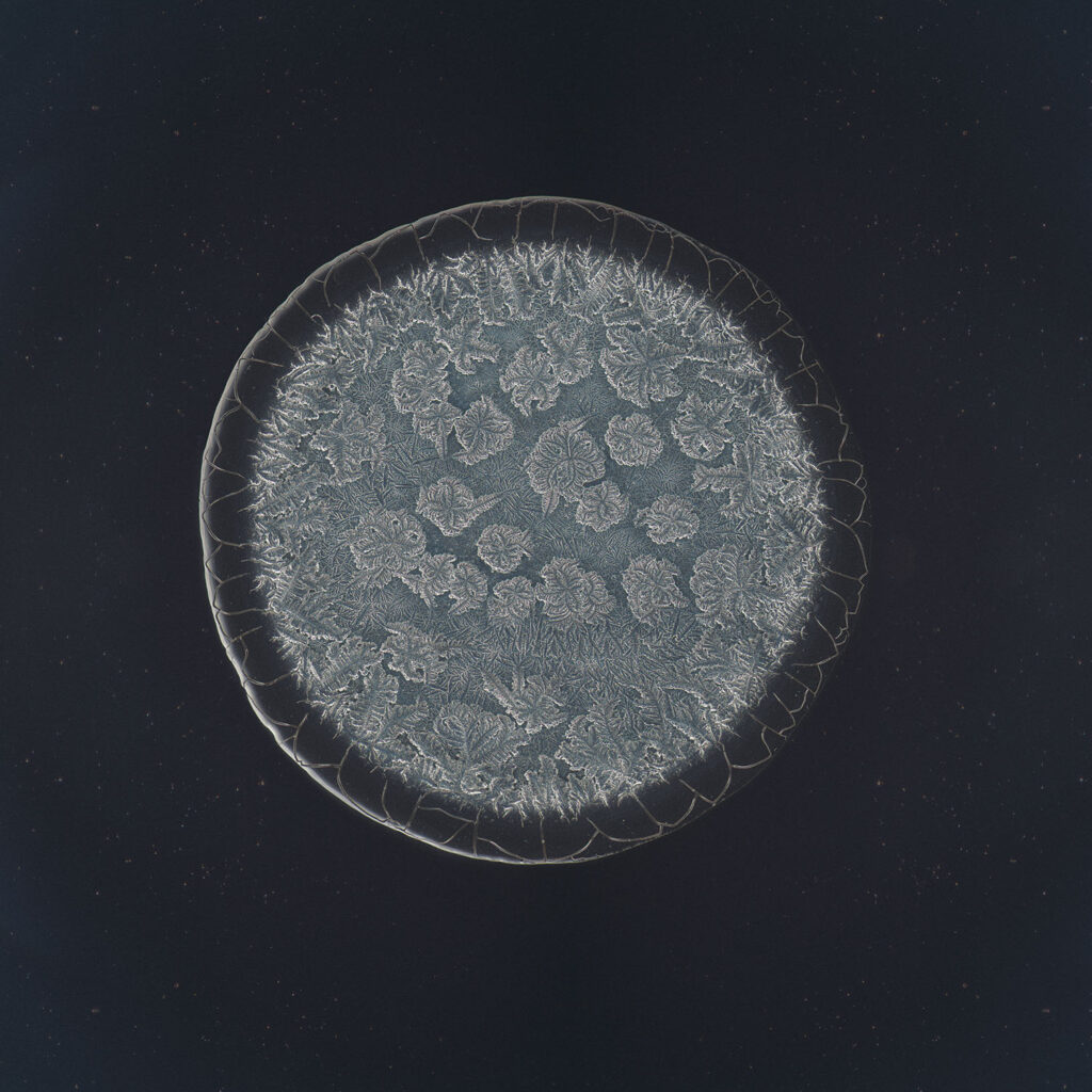 Mandy — emotional tear photographed under the microscope