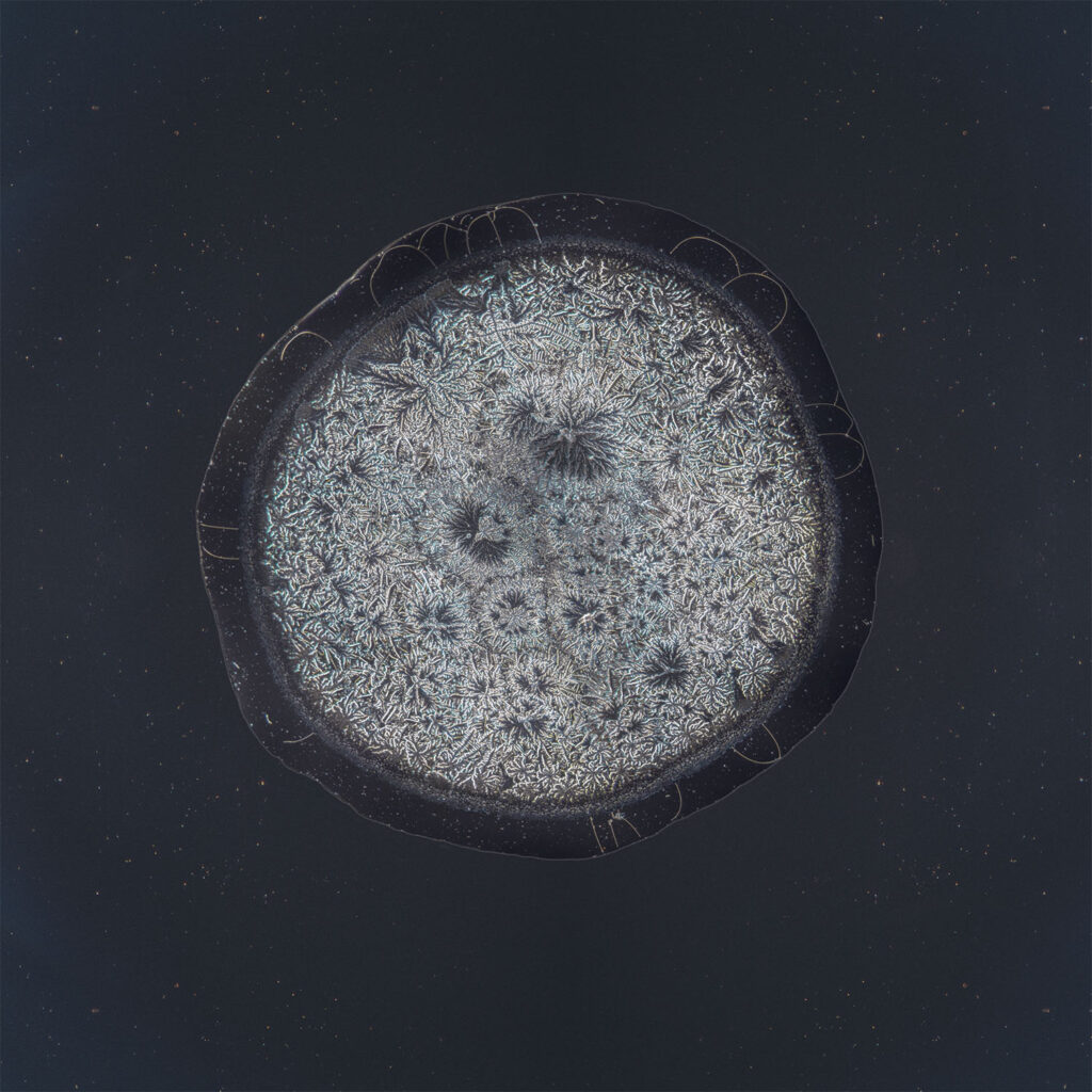 Gonney — emotional tear photographed under the microscope
