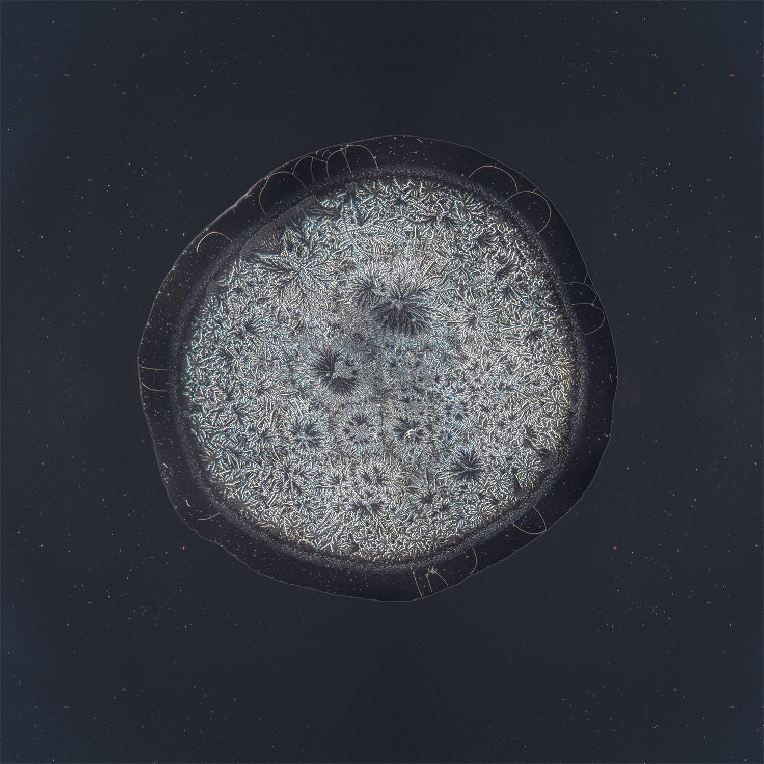Gonney tear photographed under the microscope
